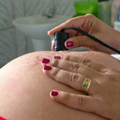 Teste para HTLV passa a ser indicado para gestantes durante pré-natal - Notícias - Mato Grosso digital