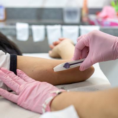 Saiba como funciona a inserção do implante contraceptivo nas USFs de Cuiabá - Notícias - Mato Grosso digital