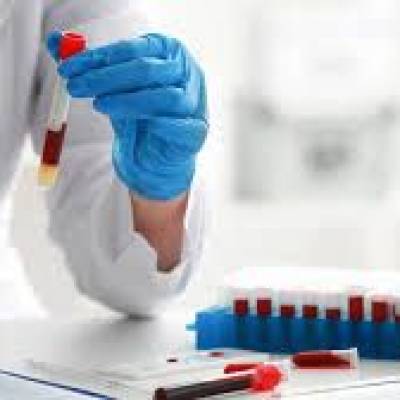 Sangue artificial é testado pela primeira vez em humanos - Notícias - Mato Grosso digital