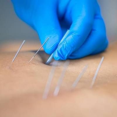 SES promove curso de acupuntura para médicos da Atenção Básica - Notícias - Mato Grosso digital
