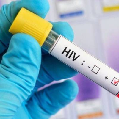 Dia Mundial de Luta contra a Aids: Oito mitos sobre o HIV que foram derrubados - Notícias - Mato Grosso digital