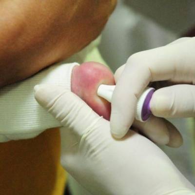 MT Hemocentro atende 599 pacientes com a doença falciforme - Notícias - Mato Grosso digital